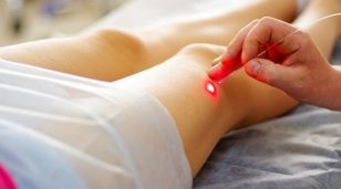 El láser de eliminación de